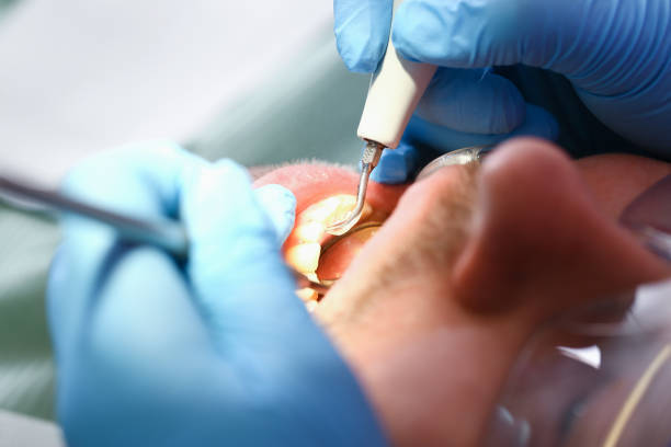 Best Emergency Tooth Extraction  in St Louis, MO